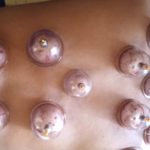 Bukanya Hari Selasa dan Jumat, Gratis  Bekam, Pijat Terkilir, Kiropraksi (pijat kretek) hingga Refleksi